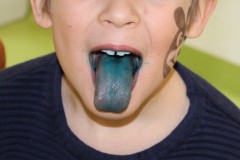blaue-Zunge